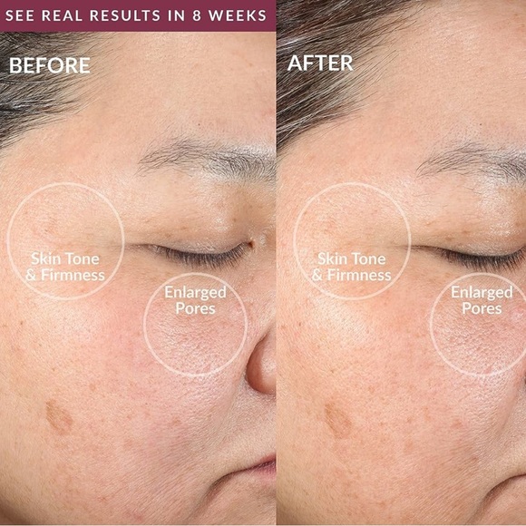 berry PMD Clean smart facial cleaning device | berry | $159 retail - Picture 7 of 9